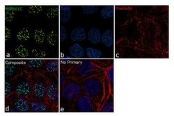 Invitrogen PIP5K1C Recombinant Rabbit Monoclonal Antibody (16H4L5) 100