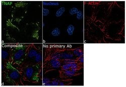 Invitrogen ALPL Recombinant Rabbit Monoclonal Antibody (7H11L3) 100 &mu;g;