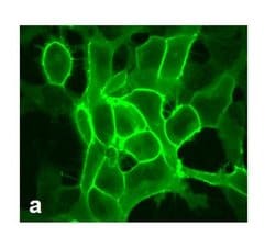 Invitrogen mGLuR2 Recombinant Rabbit Monoclonal Antibody (15H9L5) 100 &mu;g;