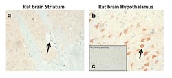 Invitrogen DRD1 Recombinant Rabbit Monoclonal Antibody (1H8L2) 100 &mu;g | Buy Online | Invitrogen&trade; | Fisher Scientific