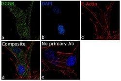 Invitrogen Glucagon Receptor Recombinant Rabbit Monoclonal Antibody (21H1L9) 100 &mu;g | Buy Online | Invitrogen&trade; | Fisher Scientific