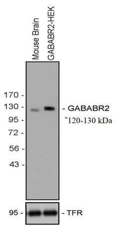 Invitrogen&trade;&nbsp;GABBR2 Recombinant Rabbit Monoclonal Antibody (23H5L12)