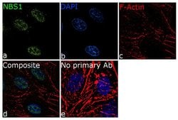 NBS1 Recombinant Rabbit Monoclonal Antibody (9H4L65), Invitrogen 100 &mu;g;