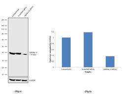 Invitrogen Aldolase A Recombinant Rabbit Monoclonal Antibody (21H7L6) 100