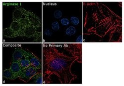 Invitrogen Arginase 1 Recombinant Rabbit Monoclonal Antibody (24H4L3) 100