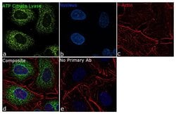 Invitrogen&trade;&nbsp;ATP Citrate Lyase Recombinant Rabbit Monoclonal Antibody (4H6L2)