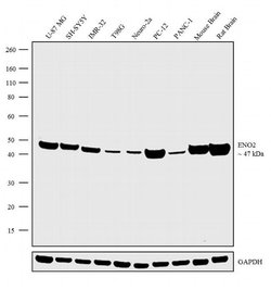Invitrogen NSE Recombinant Rabbit Monoclonal Antibody (10H7L13) 100 &mu;g | Buy Online | Invitrogen&trade; | Fisher Scientific
