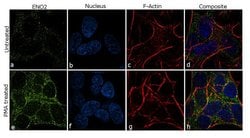 Invitrogen&trade;&nbsp;NSE Recombinant Rabbit Monoclonal Antibody (10H7L13)