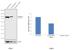 HK1 Recombinant Rabbit Monoclonal Antibody (18H16L7), Invitrogen 100 &mu;g;