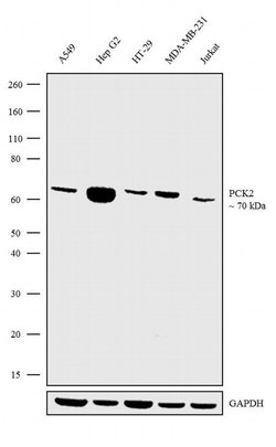 Invitrogen PCK2 Recombinant Rabbit Monoclonal Antibody (16H5L22) 100 &mu;g;
