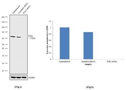 Invitrogen PCK2 Recombinant Rabbit Monoclonal Antibody (16H5L22) 100 &mu;g;
