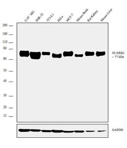 LIMP2 Recombinant Rabbit Monoclonal Antibody (12H5L1):Antibodies, Recombinant