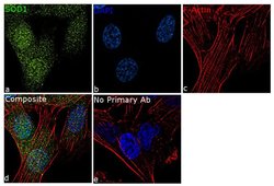 Invitrogen SOD1 Recombinant Rabbit Monoclonal Antibody (11H3L1) 100 &mu;g;