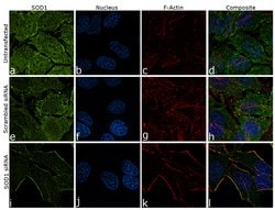 Invitrogen SOD1 Recombinant Rabbit Monoclonal Antibody (11H3L1) 100 &mu;g;