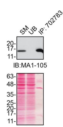 Invitrogen SOD1 Recombinant Rabbit Monoclonal Antibody (11H3L1) 100 &mu;g;