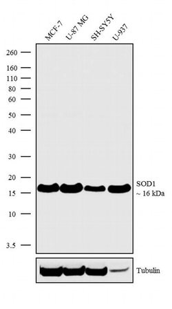Invitrogen SOD1 Recombinant Rabbit Monoclonal Antibody (11H3L1) 100 &mu;g;