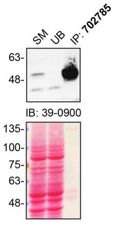 Invitrogen Parkin Recombinant Rabbit Monoclonal Antibody (21H24L9) 100