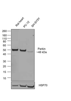 Invitrogen Parkin Chimeric Recombinant Mouse Monoclonal Antibody (21H24L9),