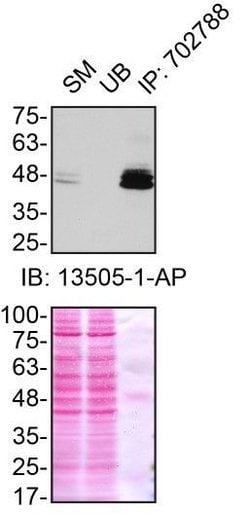 Invitrogen Ataxin 3 Recombinant Rabbit Monoclonal Antibody (13H9L9) 100