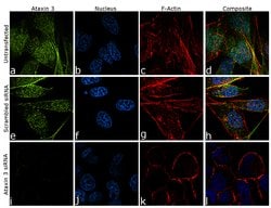 Invitrogen Ataxin 3 Recombinant Rabbit Monoclonal Antibody (13H9L9) 100