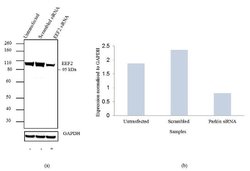 Invitrogen EEF2 Recombinant Rabbit Monoclonal Antibody (20H2L1) 100 &mu;g;