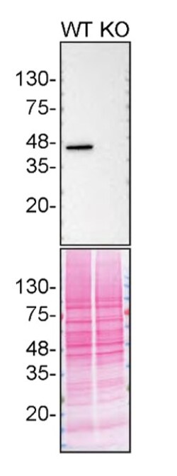 Invitrogen CK2 alpha-1 Recombinant Rabbit Monoclonal Antibody (7H29L3)