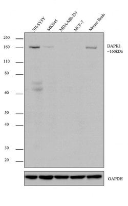 Invitrogen&trade;&nbsp;DAPK1 Recombinant Rabbit Monoclonal Antibody (7H26L19)