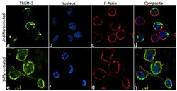 Invitrogen TREM2 Recombinant Rabbit Monoclonal Antibody (9H4L26) 100 &mu;g;