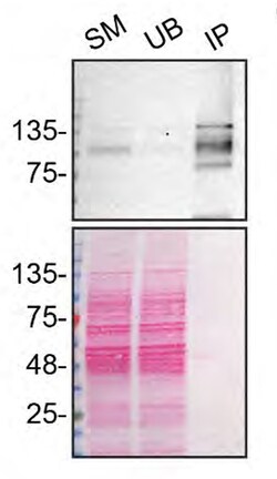 Invitrogen ADNP Recombinant Rabbit Monoclonal Antibody (16H17L68) 100 &mu;g;