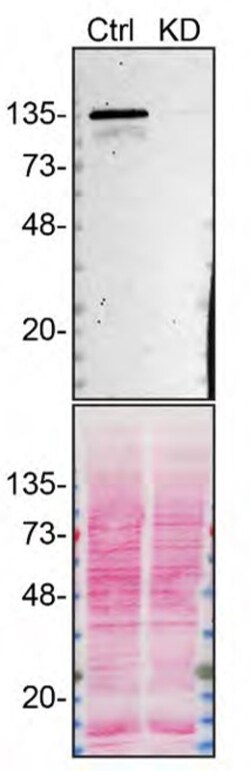 Invitrogen ADNP Recombinant Rabbit Monoclonal Antibody (16H17L68) 100 &mu;g;