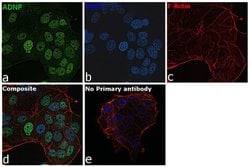 Invitrogen ADNP Recombinant Rabbit Monoclonal Antibody (16H17L68) 100 &mu;g;
