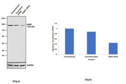 Invitrogen ADNP Recombinant Rabbit Monoclonal Antibody (16H17L68) 100 &mu;g;