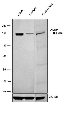 Invitrogen ADNP Recombinant Rabbit Monoclonal Antibody (16H17L68) 100 &mu;g;