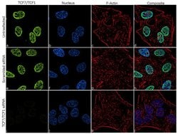 Invitrogen TCF7 Recombinant Rabbit Monoclonal Antibody (18H15L9) 100 &mu;g | Buy Online | Invitrogen&trade; | Fisher Scientific