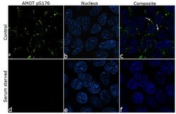 Invitrogen Phospho-AMOT (Ser175) Recombinant Rabbit Monoclonal Antibody