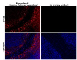 Invitrogen STING Recombinant Rabbit Monoclonal Antibody (2H1L5) 100 &mu;g | Buy Online | Invitrogen&trade; | Fisher Scientific