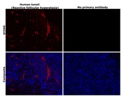Invitrogen STING Recombinant Rabbit Monoclonal Antibody (2H1L5) 100 &mu;g | Buy Online | Invitrogen&trade; | Fisher Scientific