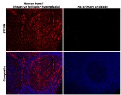 Invitrogen STING Recombinant Rabbit Monoclonal Antibody (2H1L5) 100 &mu;g | Buy Online | Invitrogen&trade; | Fisher Scientific