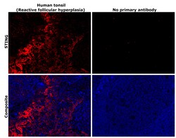Invitrogen STING Recombinant Rabbit Monoclonal Antibody (2H1L5) 100 &mu;g | Buy Online | Invitrogen&trade; | Fisher Scientific