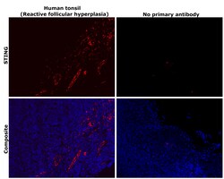 Invitrogen STING Recombinant Rabbit Monoclonal Antibody (2H1L5) 100 &mu;g | Buy Online | Invitrogen&trade; | Fisher Scientific