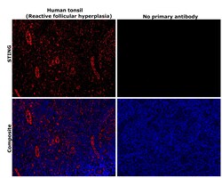 Invitrogen STING Recombinant Rabbit Monoclonal Antibody (2H1L5) 100 &mu;g | Buy Online | Invitrogen&trade; | Fisher Scientific