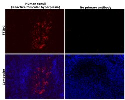 Invitrogen STING Recombinant Rabbit Monoclonal Antibody (2H1L5) 100 &mu;g | Buy Online | Invitrogen&trade; | Fisher Scientific