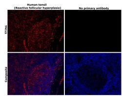 Invitrogen STING Recombinant Rabbit Monoclonal Antibody (2H1L5) 100 &mu;g | Buy Online | Invitrogen&trade; | Fisher Scientific