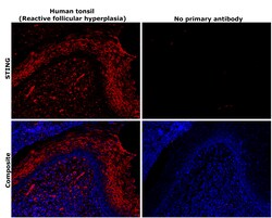Invitrogen STING Recombinant Rabbit Monoclonal Antibody (2H1L5) 100 &mu;g | Buy Online | Invitrogen&trade; | Fisher Scientific