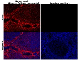 Invitrogen STING Recombinant Rabbit Monoclonal Antibody (2H1L5) 100 &mu;g | Buy Online | Invitrogen&trade; | Fisher Scientific