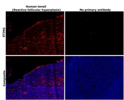 Invitrogen STING Recombinant Rabbit Monoclonal Antibody (2H1L5) 100 &mu;g | Buy Online | Invitrogen&trade; | Fisher Scientific