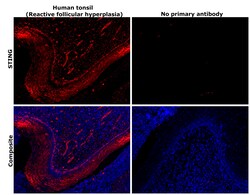 Invitrogen STING Recombinant Rabbit Monoclonal Antibody (2H1L5) 100 &mu;g | Buy Online | Invitrogen&trade; | Fisher Scientific