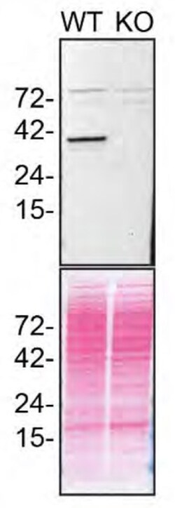 Invitrogen STING Recombinant Rabbit Monoclonal Antibody (2H1L5) 100 &mu;g | Buy Online | Invitrogen&trade; | Fisher Scientific
