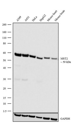 Invitrogen MST2 Recombinant Rabbit Monoclonal Antibody (19H19L39) 100 &mu;g;