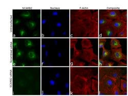Invitrogen LIMP2 Recombinant Rabbit Monoclonal Antibody (22H6L14) 100 &mu;g;